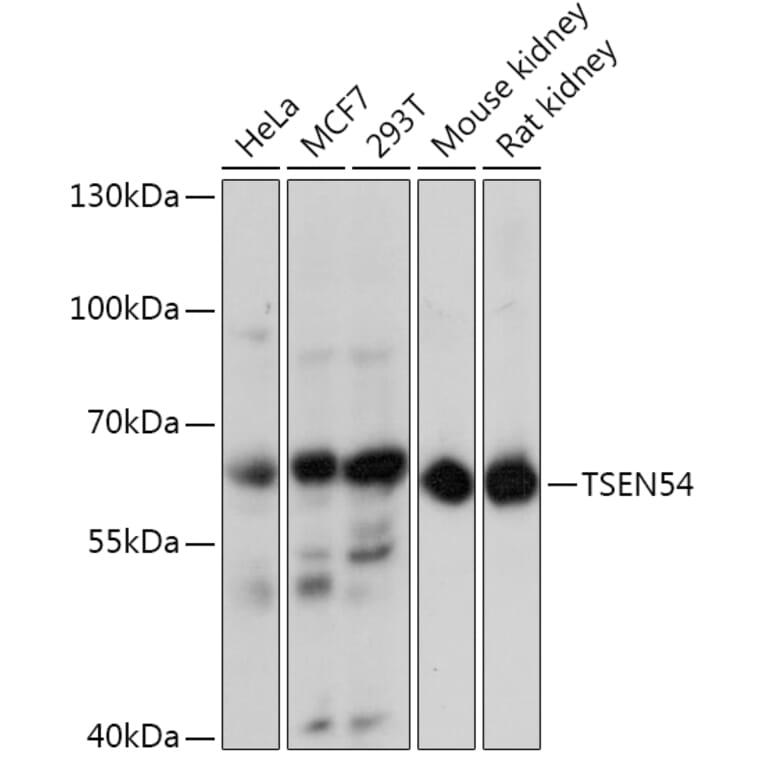 Western Blot - Anti-TSEN54 Antibody (A92103) - Antibodies.com