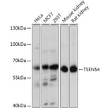 Western Blot - Anti-TSEN54 Antibody (A92103) - Antibodies.com
