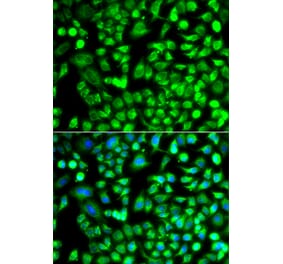 Immunofluorescence - Anti-ALKBH4 Antibody (A92104) - Antibodies.com