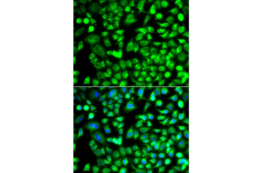 Immunofluorescence - Anti-ALKBH4 Antibody (A92104) - Antibodies.com