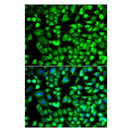 Immunofluorescence - Anti-ALKBH4 Antibody (A92104) - Antibodies.com