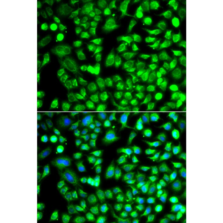 Immunofluorescence - Anti-ALKBH4 Antibody (A92104) - Antibodies.com
