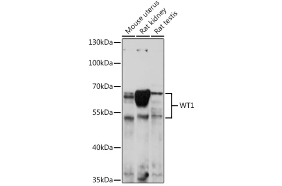 Western Blot - Anti-Wilms Tumor Protein Antibody (A92105) - Antibodies.com