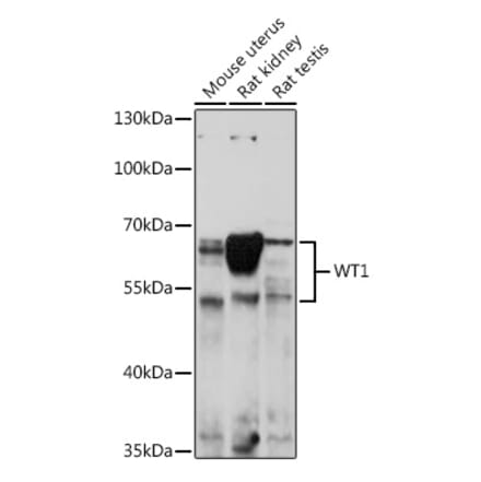 Western Blot - Anti-Wilms Tumor Protein Antibody (A92105) - Antibodies.com