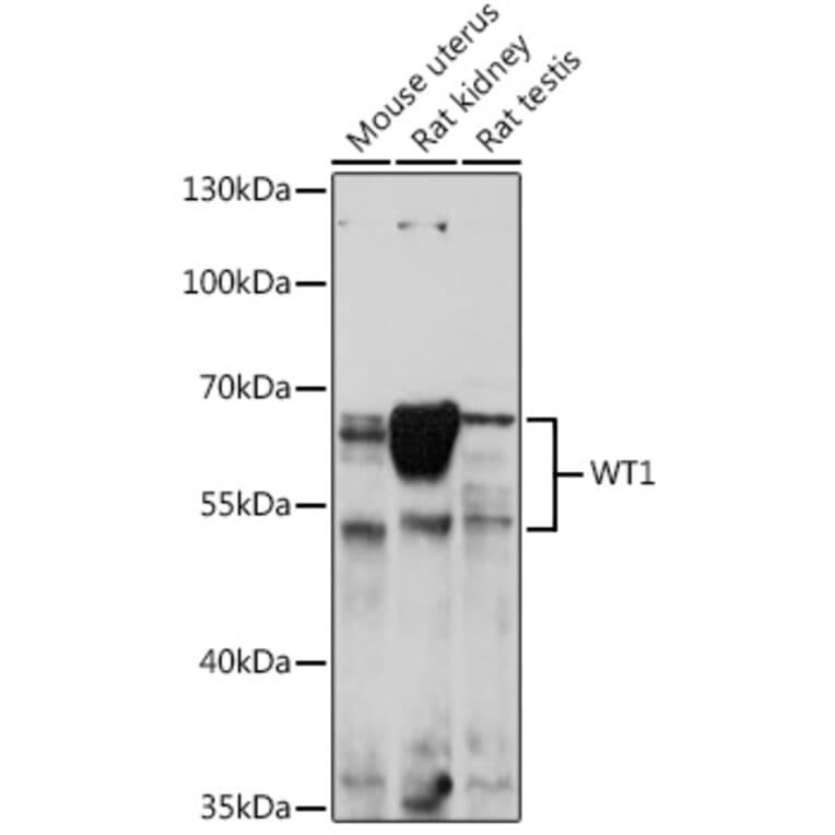 Western Blot - Anti-Wilms Tumor Protein Antibody (A92105) - Antibodies.com