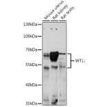 Western Blot - Anti-Wilms Tumor Protein Antibody (A92105) - Antibodies.com