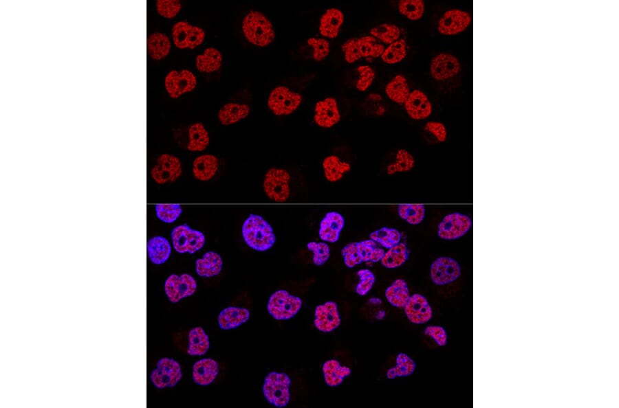 Immunofluorescence - Anti-Wilms Tumor Protein Antibody (A92105) - Antibodies.com
