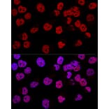 Immunofluorescence - Anti-Wilms Tumor Protein Antibody (A92105) - Antibodies.com