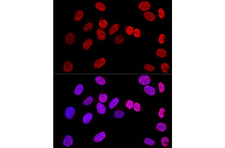 Immunofluorescence - Anti-Wilms Tumor Protein Antibody (A92105) - Antibodies.com