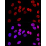 Immunofluorescence - Anti-Wilms Tumor Protein Antibody (A92105) - Antibodies.com