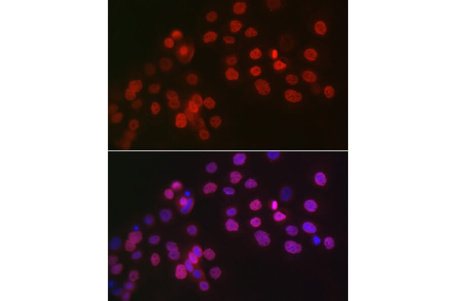 Immunofluorescence - Anti-Wilms Tumor Protein Antibody (A92105) - Antibodies.com