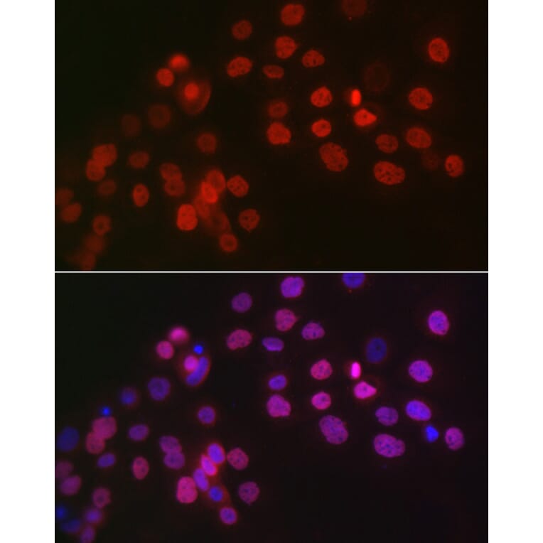 Immunofluorescence - Anti-Wilms Tumor Protein Antibody (A92105) - Antibodies.com