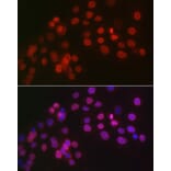 Immunofluorescence - Anti-Wilms Tumor Protein Antibody (A92105) - Antibodies.com