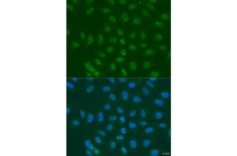 Immunofluorescence - Anti-LSM11 Antibody (A15210) - Antibodies.com