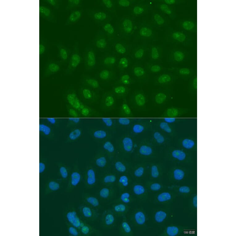 Immunofluorescence - Anti-LSM11 Antibody (A15210) - Antibodies.com