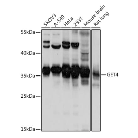 Western Blot - Anti-CEE Antibody (A92111) - Antibodies.com