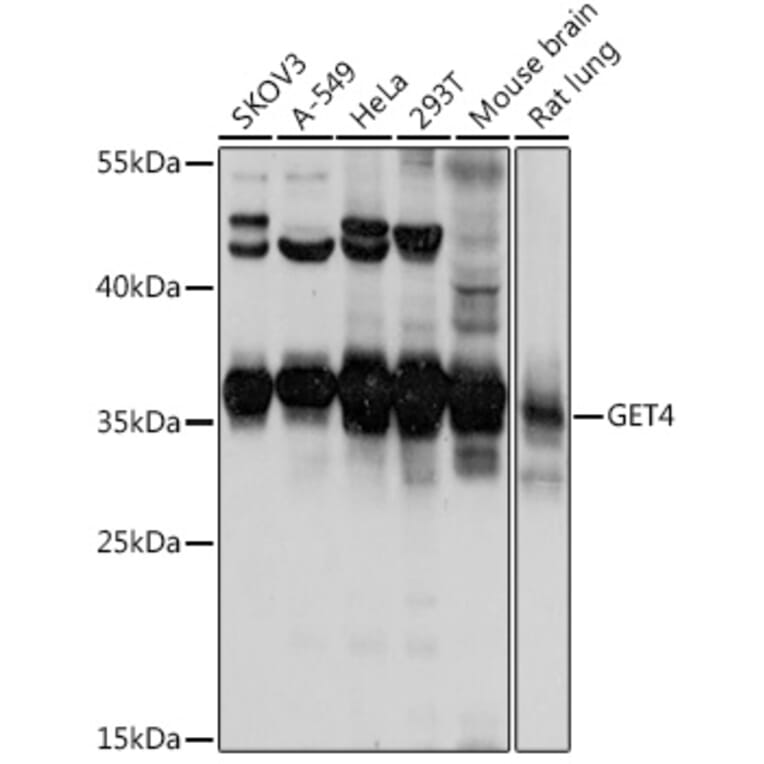 Western Blot - Anti-CEE Antibody (A92111) - Antibodies.com