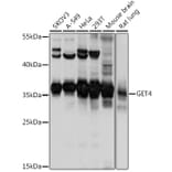 Western Blot - Anti-CEE Antibody (A92111) - Antibodies.com