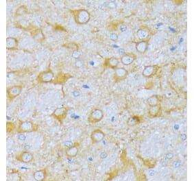 Immunohistochemistry - Anti-SBCAD Antibody (A92113) - Antibodies.com