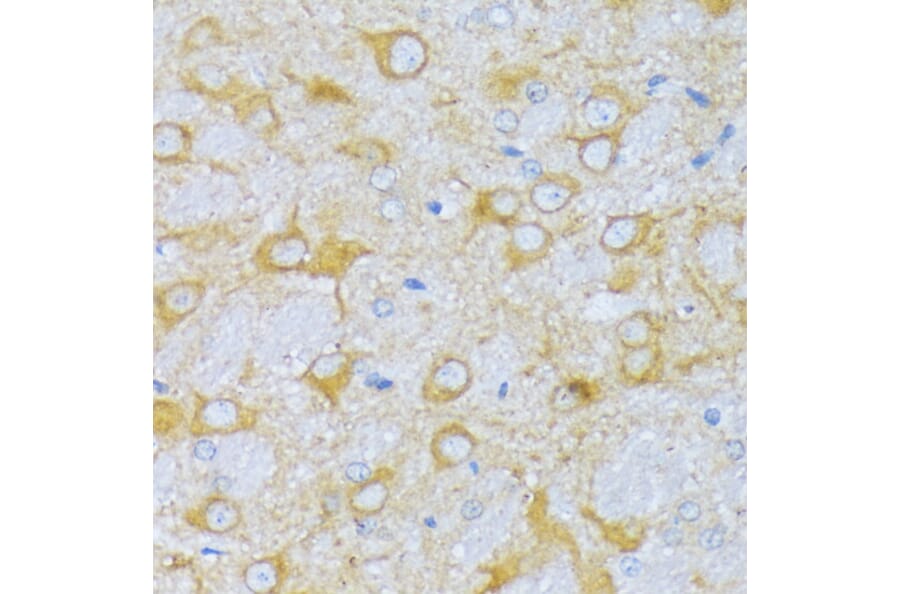 Immunohistochemistry - Anti-SBCAD Antibody (A92113) - Antibodies.com