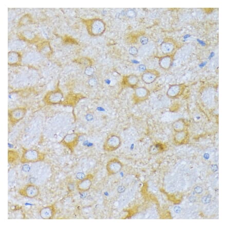 Immunohistochemistry - Anti-SBCAD Antibody (A92113) - Antibodies.com