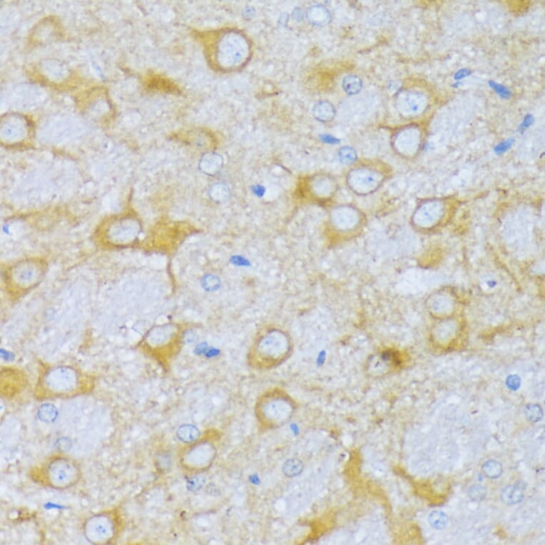 Immunohistochemistry - Anti-SBCAD Antibody (A92113) - Antibodies.com