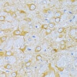 Immunohistochemistry - Anti-SBCAD Antibody (A92113) - Antibodies.com