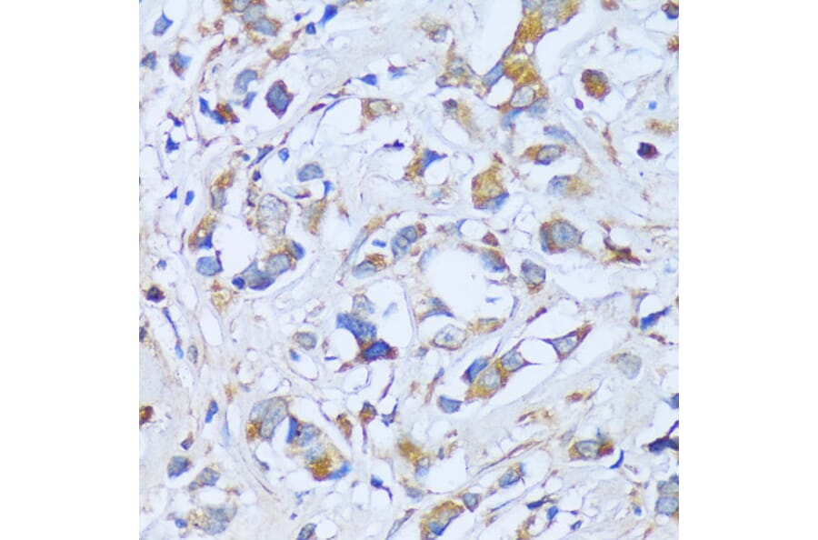 Immunohistochemistry - Anti-SBCAD Antibody (A92113) - Antibodies.com