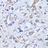 Immunohistochemistry - Anti-SBCAD Antibody (A92113) - Antibodies.com