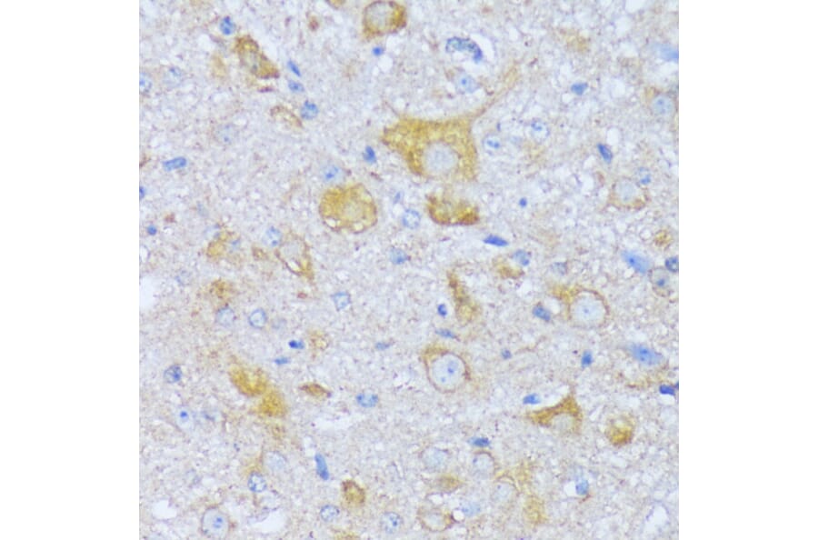 Immunohistochemistry - Anti-SBCAD Antibody (A92113) - Antibodies.com