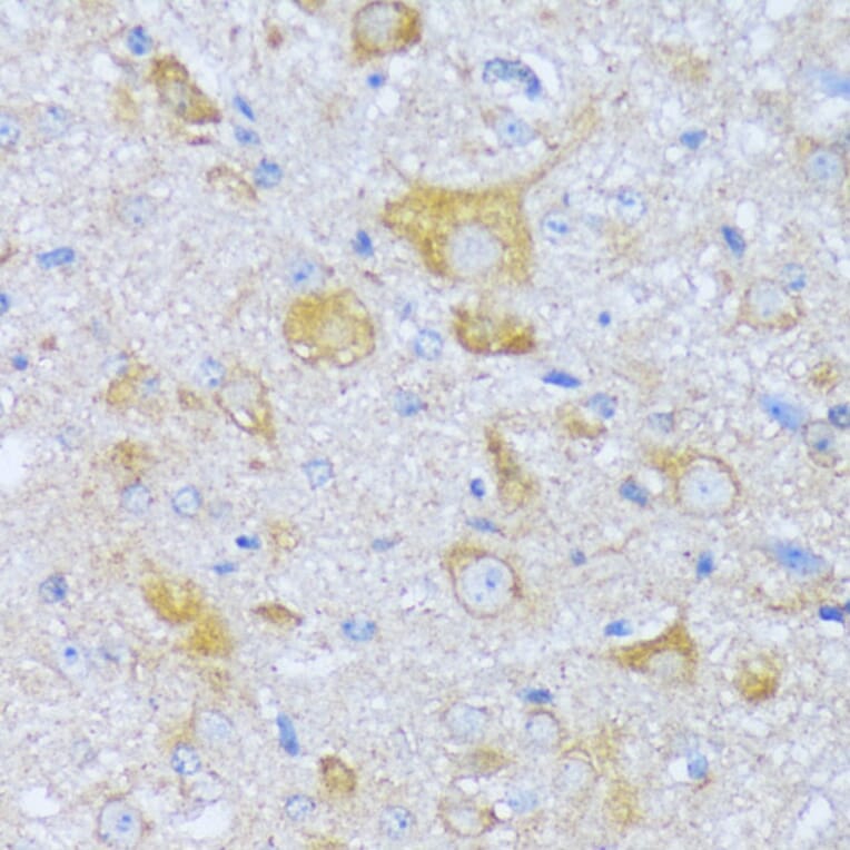Immunohistochemistry - Anti-SBCAD Antibody (A92113) - Antibodies.com
