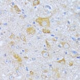 Immunohistochemistry - Anti-SBCAD Antibody (A92113) - Antibodies.com