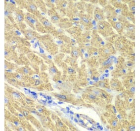 Immunohistochemistry - Anti-PICOT Antibody (A92114) - Antibodies.com