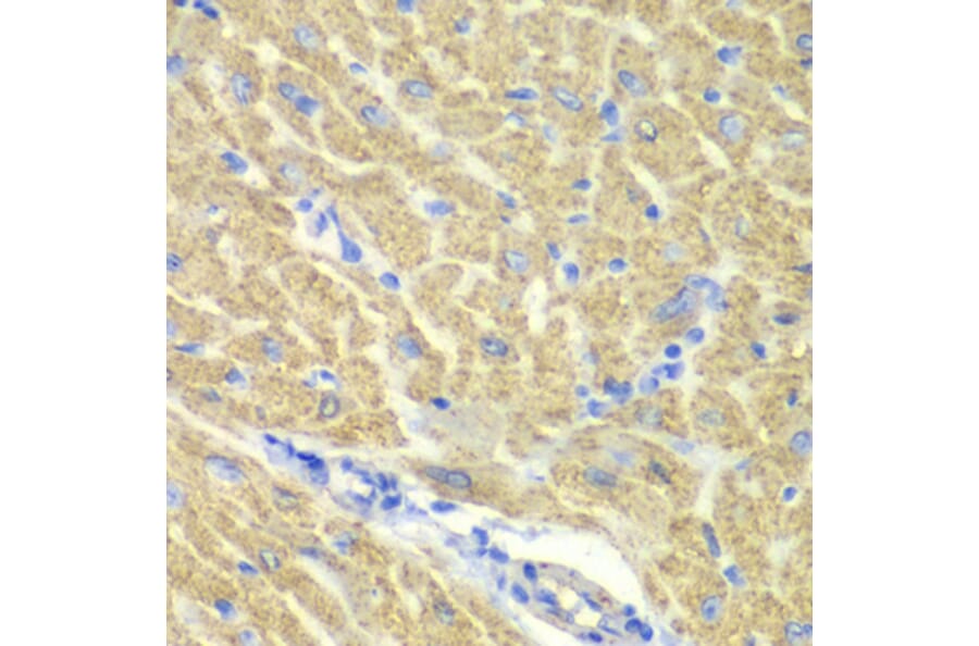 Immunohistochemistry - Anti-PICOT Antibody (A92114) - Antibodies.com
