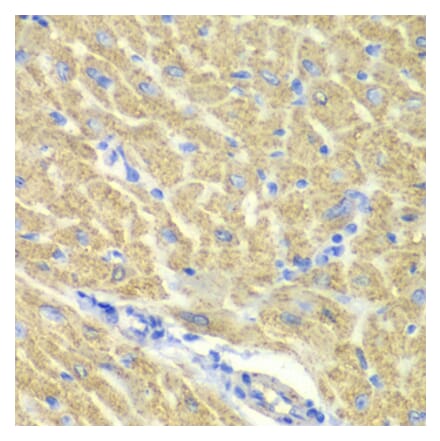 Immunohistochemistry - Anti-PICOT Antibody (A92114) - Antibodies.com