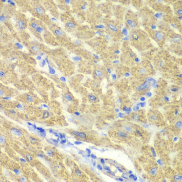 Immunohistochemistry - Anti-PICOT Antibody (A92114) - Antibodies.com