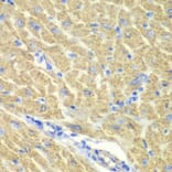 Immunohistochemistry - Anti-PICOT Antibody (A92114) - Antibodies.com