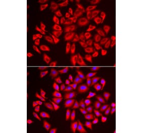 Immunofluorescence - Anti-WDR68 Antibody (A92116) - Antibodies.com