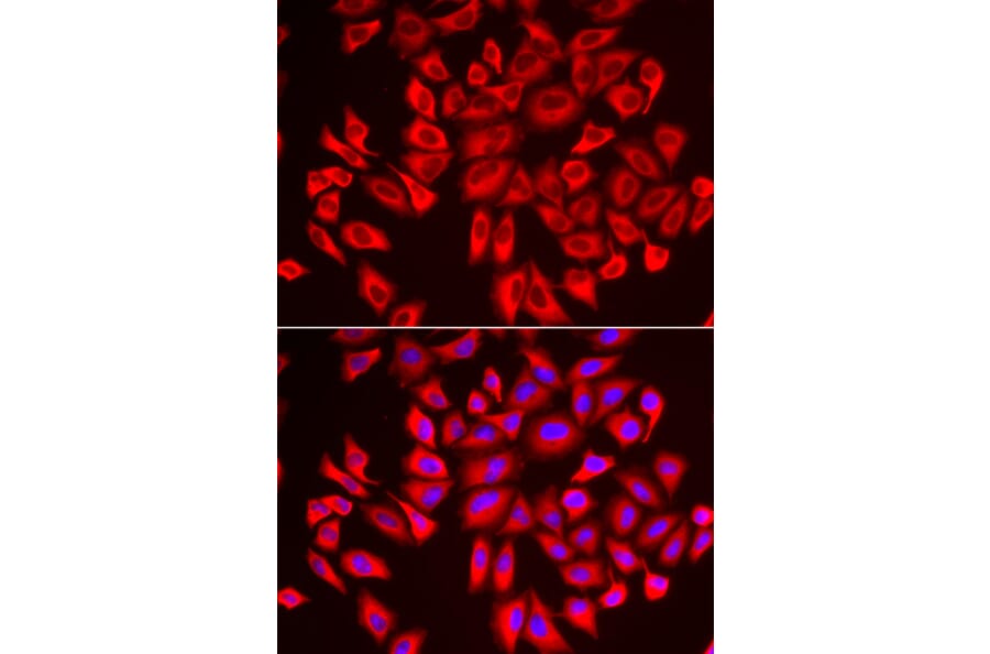 Immunofluorescence - Anti-WDR68 Antibody (A92116) - Antibodies.com
