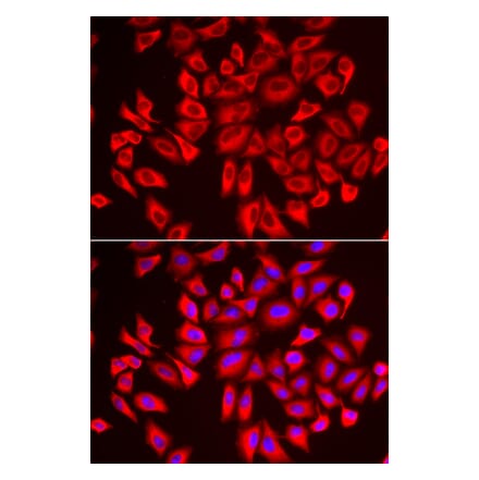 Immunofluorescence - Anti-WDR68 Antibody (A92116) - Antibodies.com