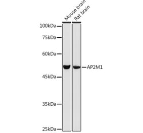 Western Blot - Anti-AP2M1 Antibody (A92117) - Antibodies.com