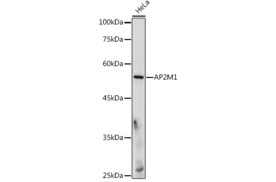 Western Blot - Anti-AP2M1 Antibody (A92117) - Antibodies.com