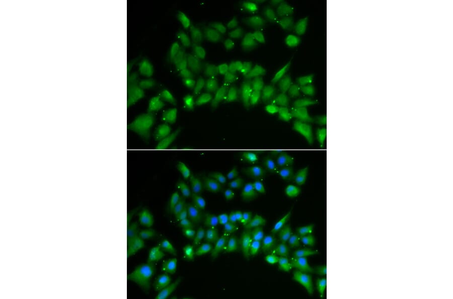 Immunofluorescence - Anti-ISL1 Antibody (A5245) - Antibodies.com