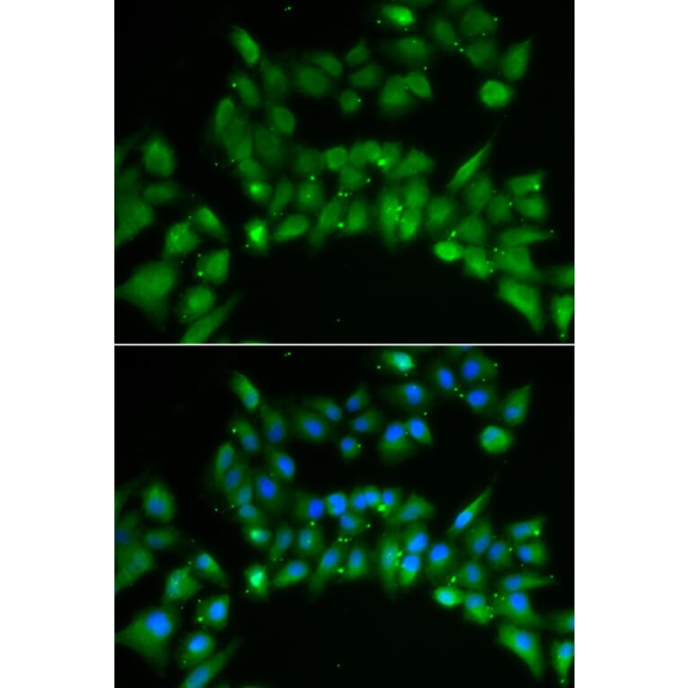 Immunofluorescence - Anti-ISL1 Antibody (A5245) - Antibodies.com