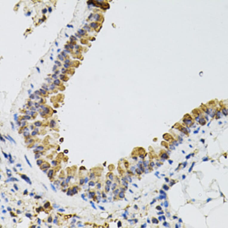 Immunohistochemistry - Anti-ARHGEF2 Antibody (A12547) - Antibodies.com