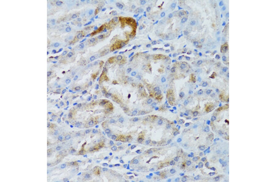 Immunohistochemistry - Anti-MOAP1 Antibody (A12599) - Antibodies.com