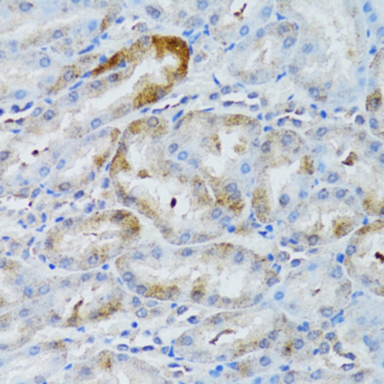Immunohistochemistry - Anti-MOAP1 Antibody (A12599) - Antibodies.com