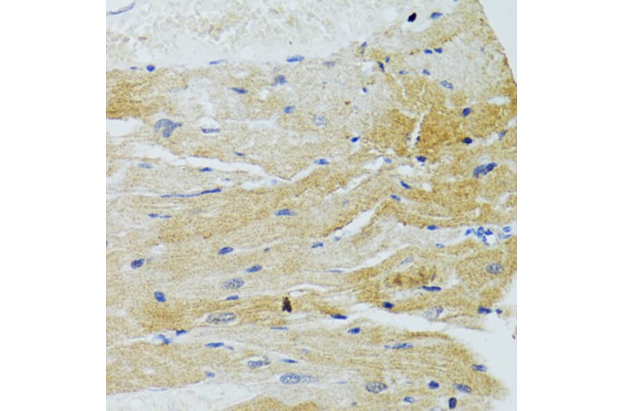 Immunohistochemistry - Anti-MOAP1 Antibody (A12599) - Antibodies.com