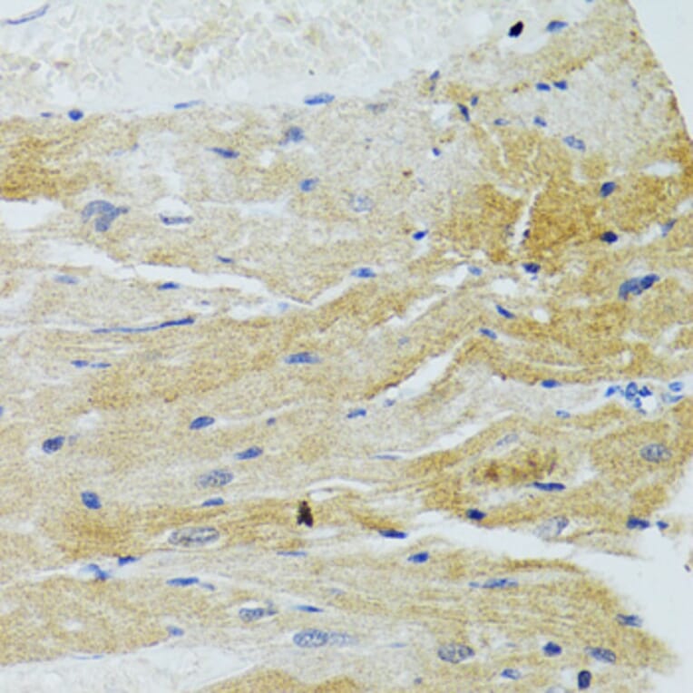 Immunohistochemistry - Anti-MOAP1 Antibody (A12599) - Antibodies.com