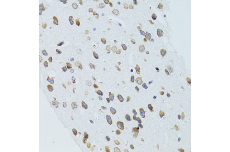 Immunohistochemistry - Anti-MOAP1 Antibody (A12599) - Antibodies.com